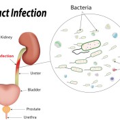 Urinary-Tract-Infections