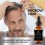 Best Minoxidil for Hair Loss  Ultra Strength Hair Regrowth Treatment