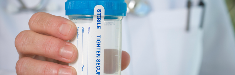 Pass a Urine Drug Test Fast