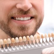 rowley regis teeth whitening