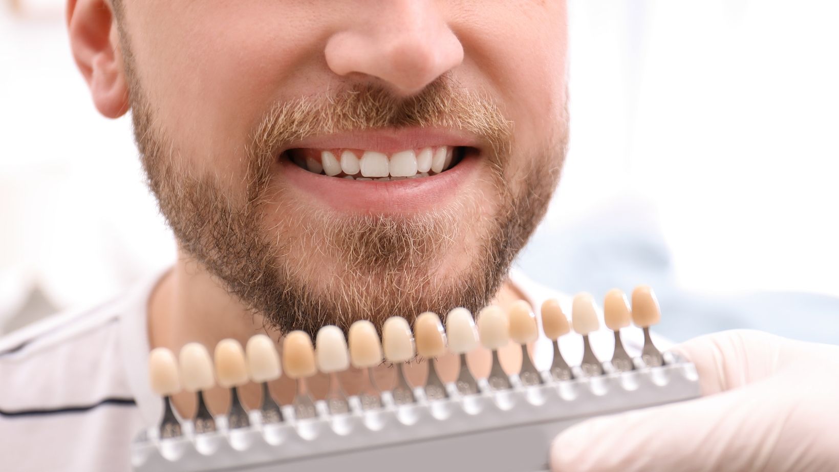 rowley regis teeth whitening